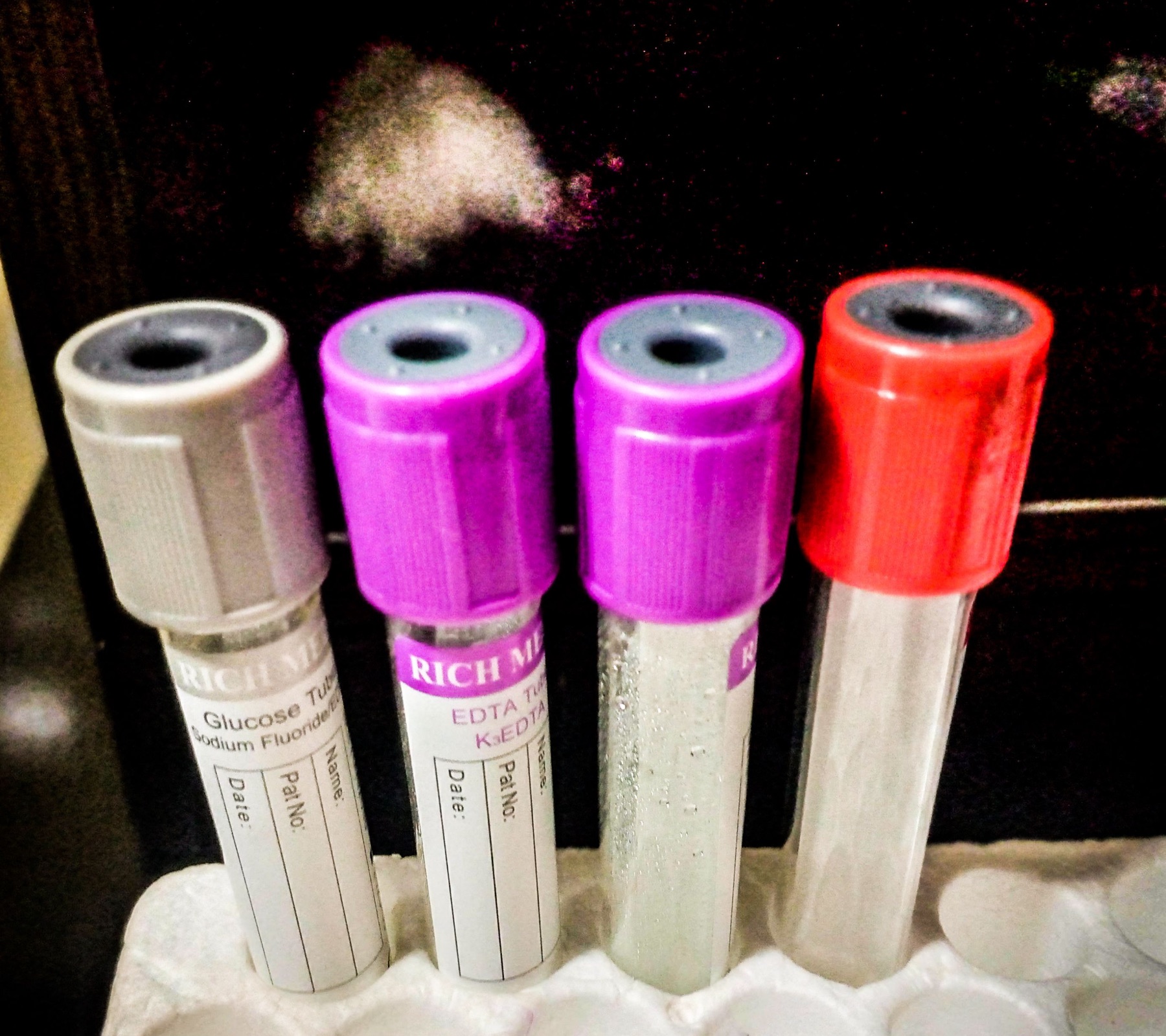 tubes de prélèvement sanguin de couleurs différentes dans un portoir de laboratoire