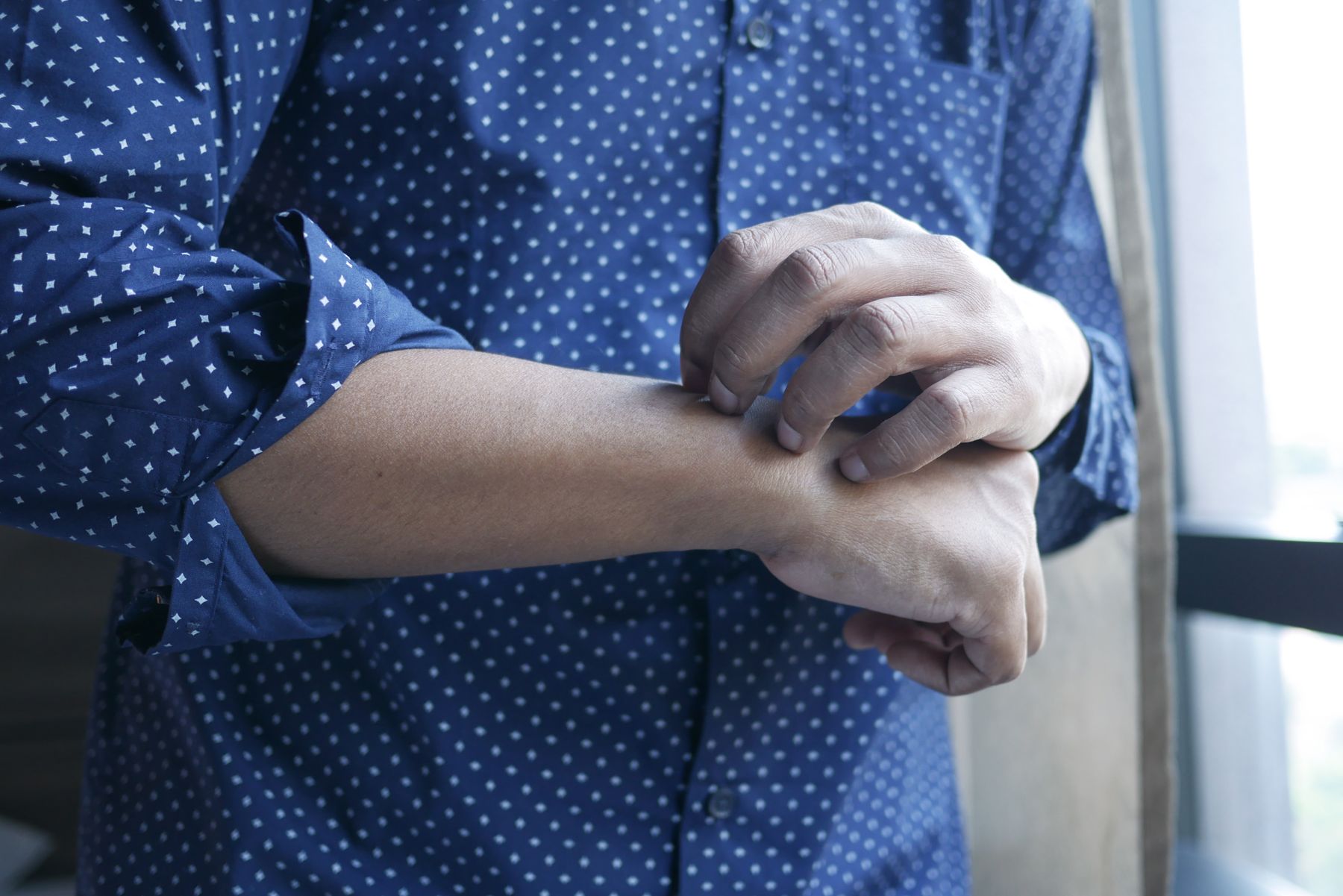 homme en chemise à manches retroussées qui se gratte le poignet