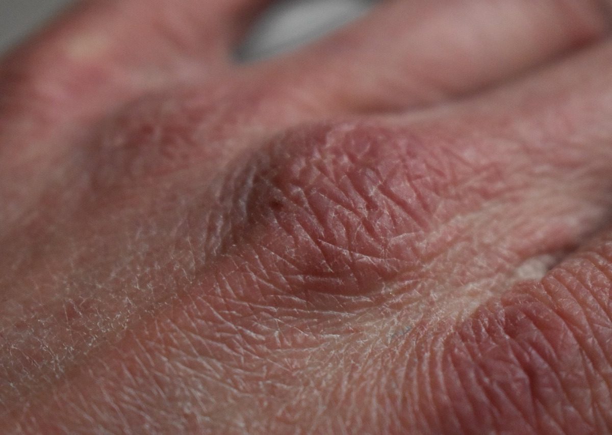 Peau & soins du corps